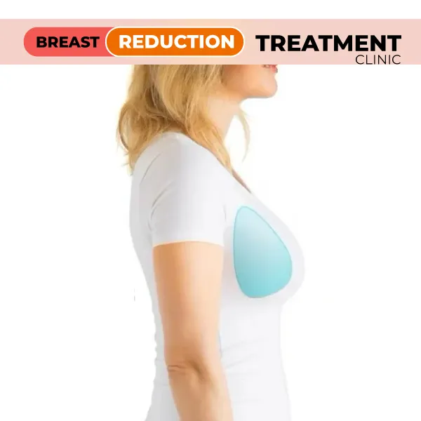 breast reduction