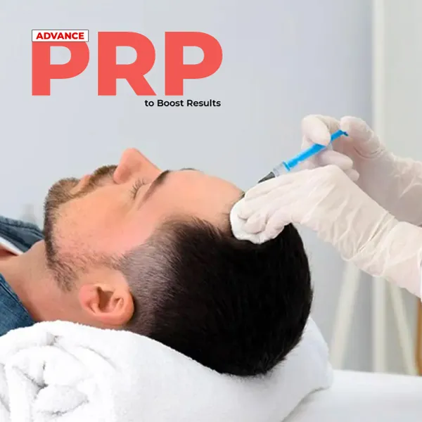 prp with hair transplant