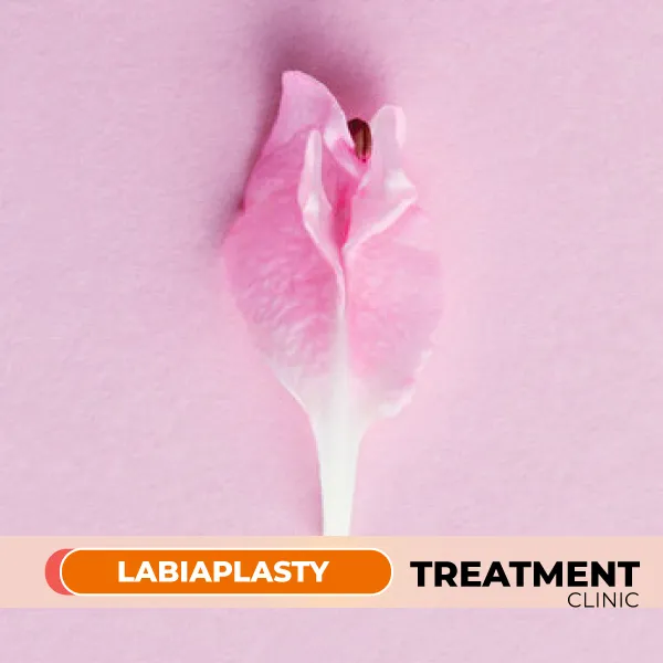 labiaplasty