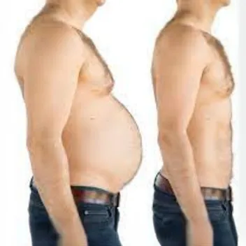 weight loss drips before after