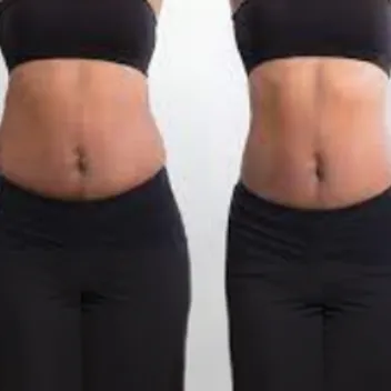 tummy tuck