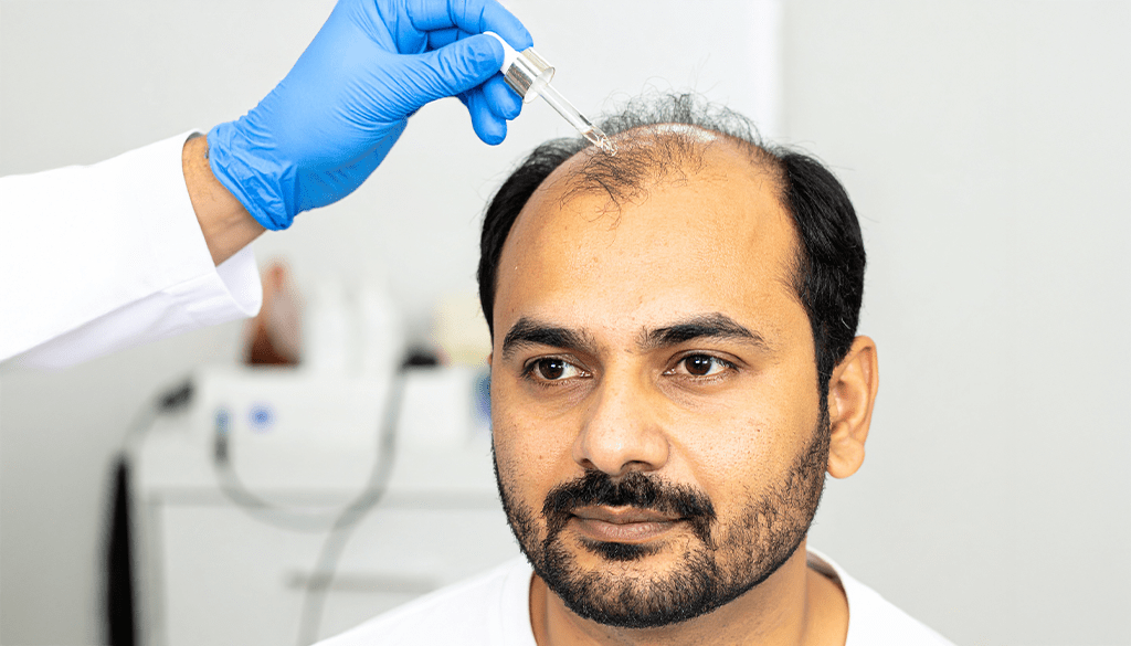 Hair PRP Treatment: Get Healthier and Stronger Hair Instantly