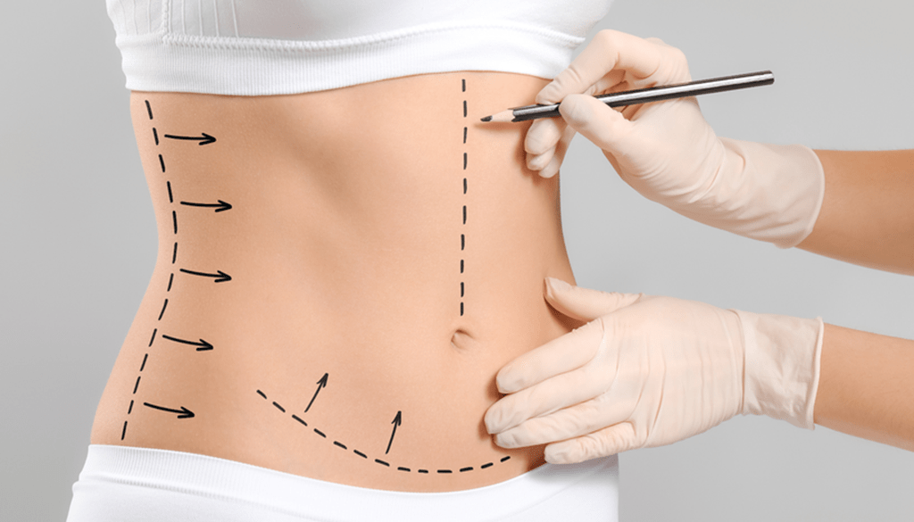Is Liposuction Effective for Eliminating Stubborn Fat? Find Out the Truth